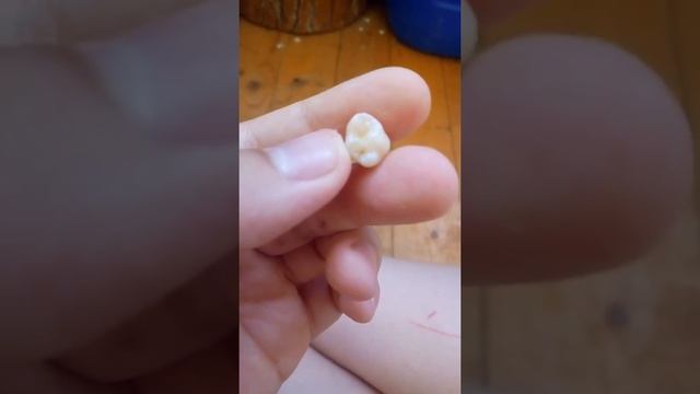 ура я вырвал зуб！