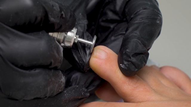 Урок по обработке пальцев стоп с помощью Смарт-диска