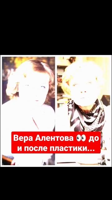 Вера Алентова 👀 до и после пластики...#shorts #short #алентова