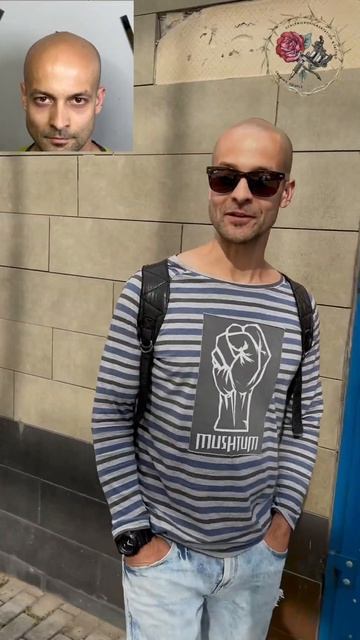 «Я готов войти в это лето обновленным»! Тотальная смена имиджа и прически Трихопигментация. SMP смотреть онлайн