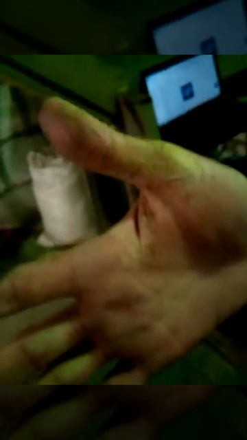 кожа слезла(((2видео)