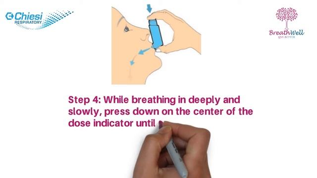 Chiesi Whiteboard HD смотреть онлайн