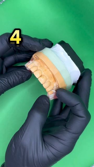 Зубные протезы , новые зубы #dental #dentist #стоматолог #doctor