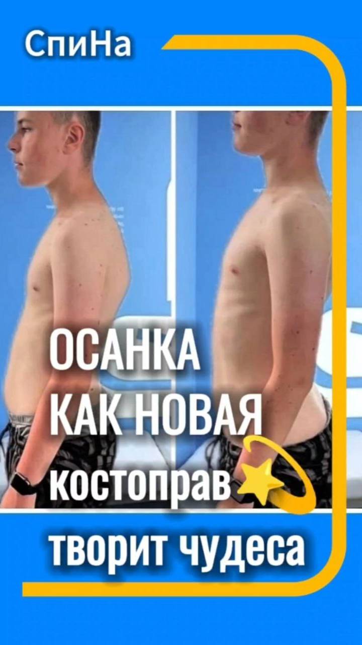 Как костоправ меняет осанку #костоправмосква #правкаспины #босанка #чтоделать #каклечить смотреть онлайн
