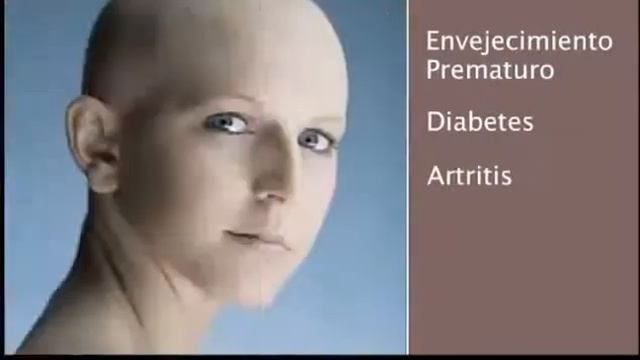 Oxidación, Radicales Libres y Antioxidantes La Cura del Cáncer смотреть онлайн
