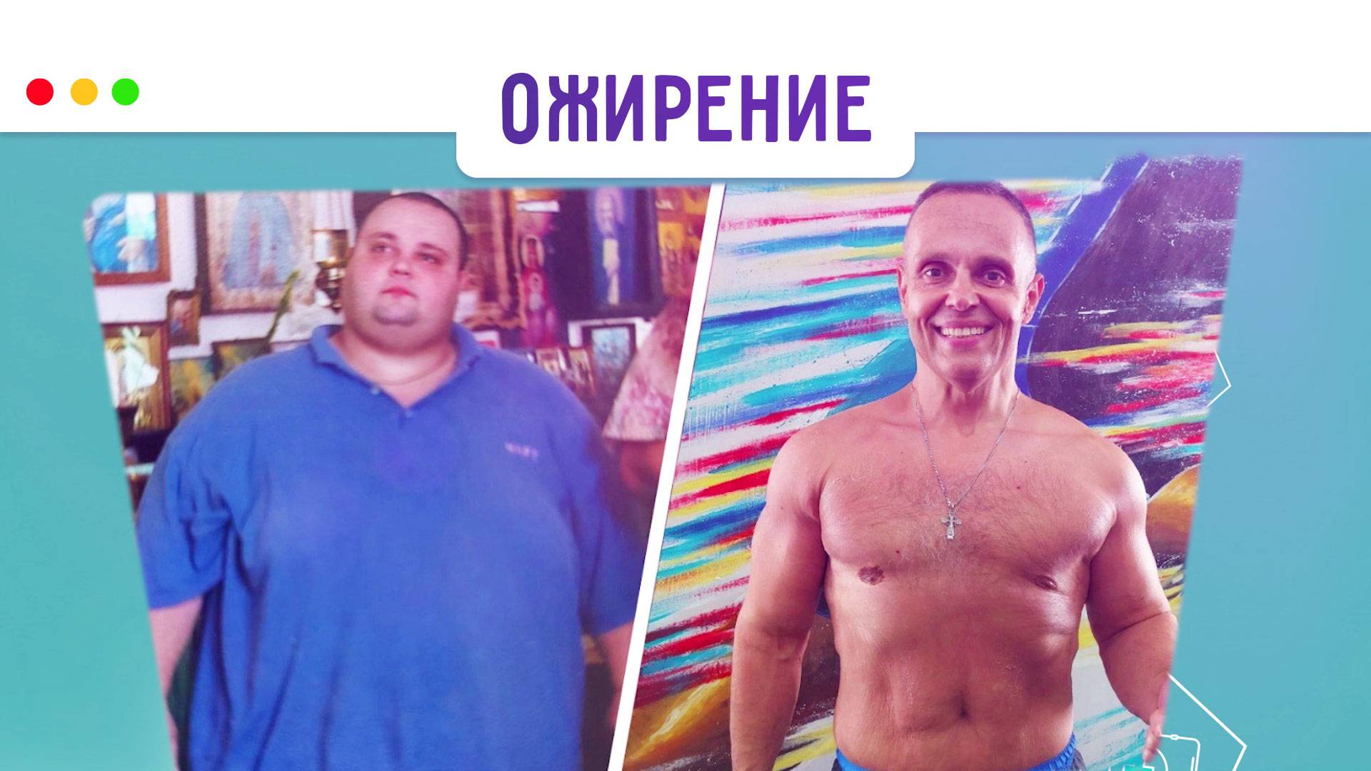 Профилактика ожирения. МЕДСОВЕТ