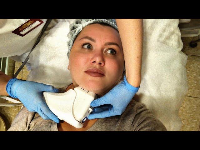 УБИРАЮ ВТОРОЙ ПОДБОРОДОК HIFU SMAS-ЛИФТИНГ