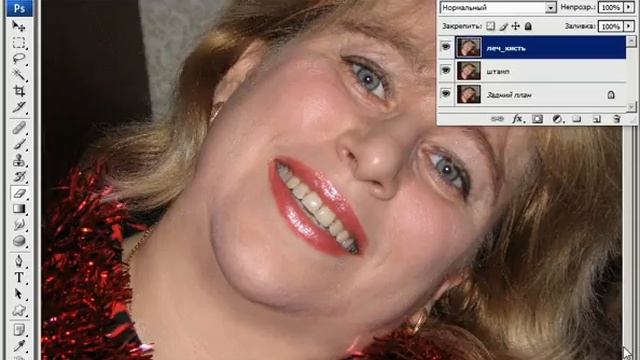 ПЛАСТИЧЕСКАЯ ХИРУРГИЯ