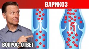 Как избавиться от варикоза 👉 лучший способ и профилактика
