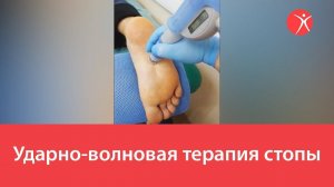 Ударно-волновая терапия стопы