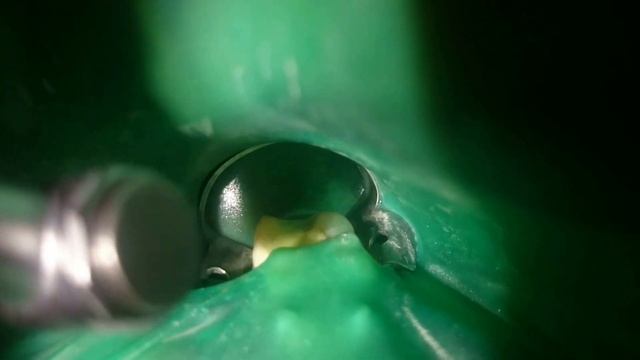 Очень маленький рот смотреть онлайн