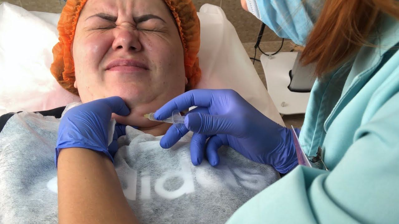 ВЛОГ УБИРАЮ ВТОРОЙ ПОДБОРОДОК ЛИПОЛИТИКАМИ