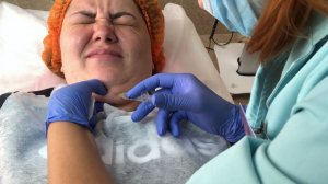 ВЛОГ УБИРАЮ ВТОРОЙ ПОДБОРОДОК ЛИПОЛИТИКАМИ