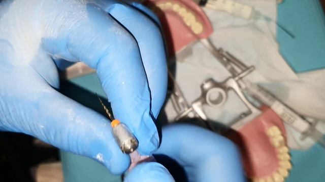 How to avoid Broken instruments during Root canals смотреть онлайн