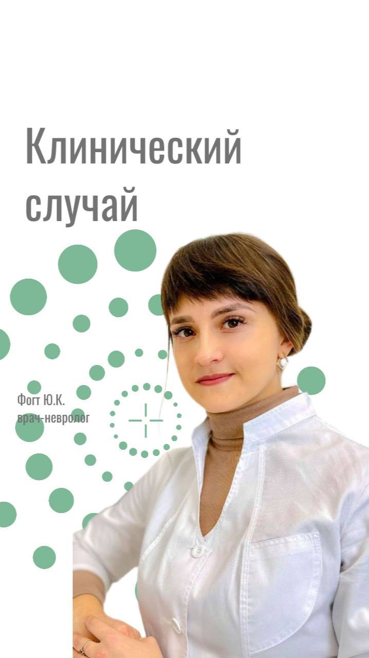 Тромбоз мозговых синусов