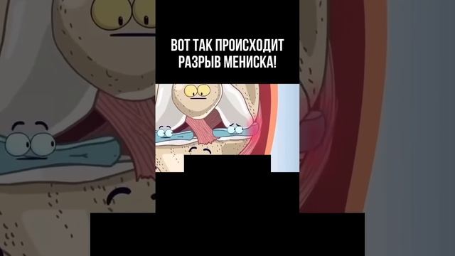 Травма колена озвучил врач Георгий Темичев #реабилитация #спортивнаямедицина #спорт #мениск #травма смотреть онлайн