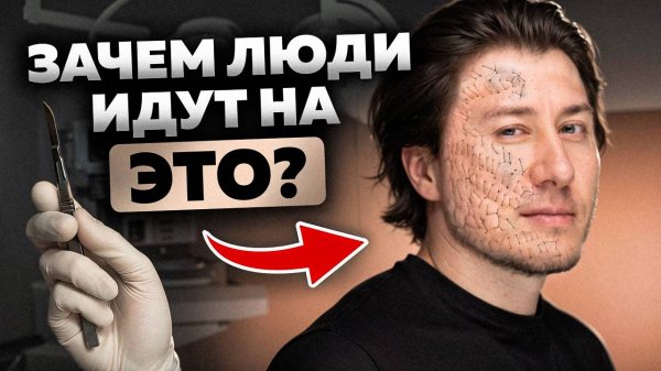 Зачем кожу ПРОШИВАЮТ НАСКВОЗЬ? Подтяжка БЕЗ ШРАМОВ - это РЕАЛЬНО! Сетка Ауерсвальда