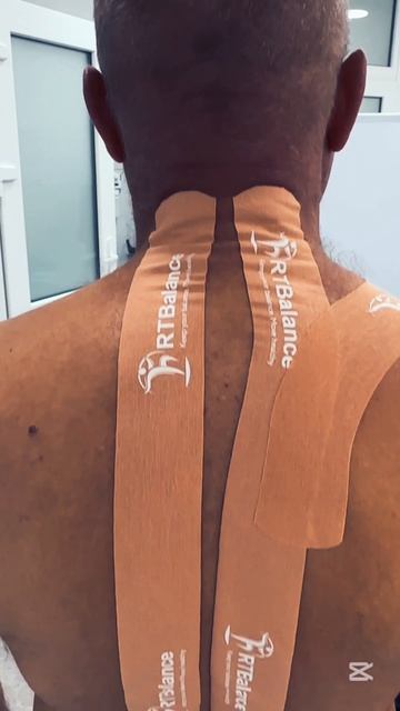 тейпирование RTBalance при обострении шейного остеохондроза смотреть онлайн