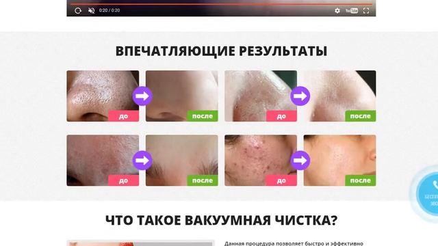 Вакуумный очиститель кожи spot cleaner отзывы смотреть онлайн
