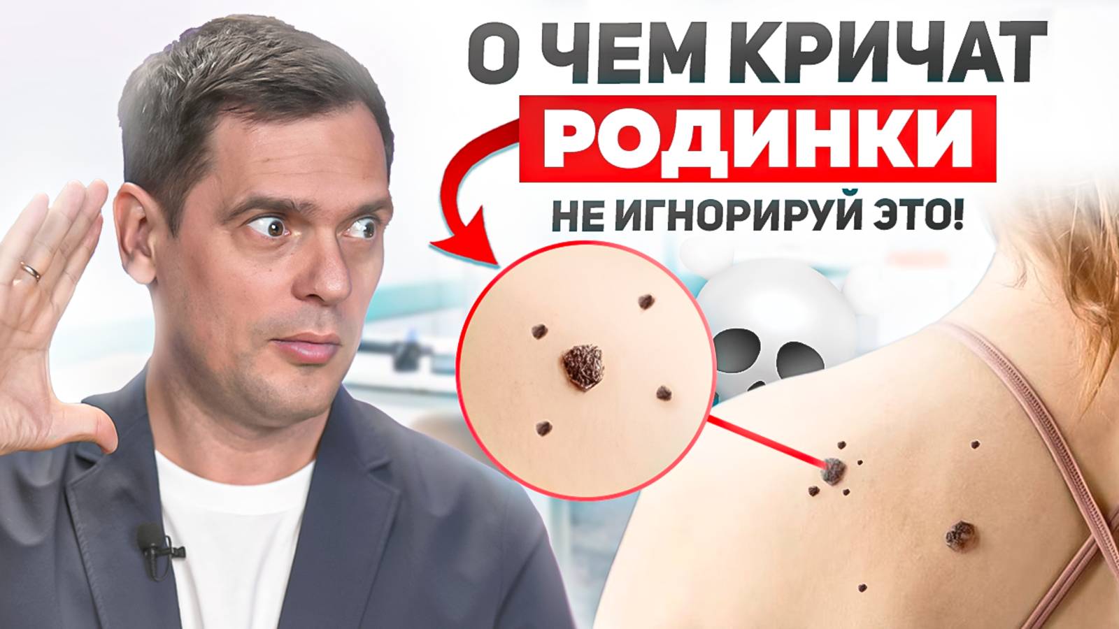 Родинка - это СИГНАЛ! Не игнорируй его! смотреть онлайн