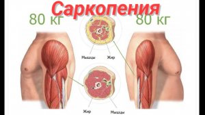 Саркопения. Потеря мышечной массы и силы.
