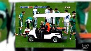 5 ЖУТКИХ ТРАВМ В ФУТБОЛЕ