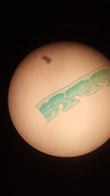 dicot leaf L. s. #shots #biology #botany смотреть онлайн