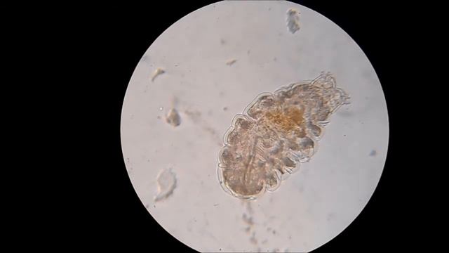 Tardigrade Tun - Rehydrated смотреть онлайн