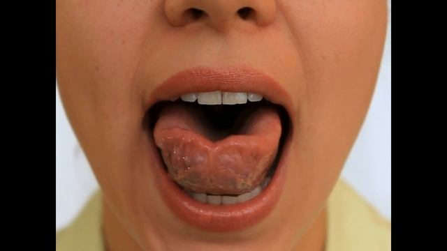 Артикуляционная Гимнастика -  Чашка и блюдце 2