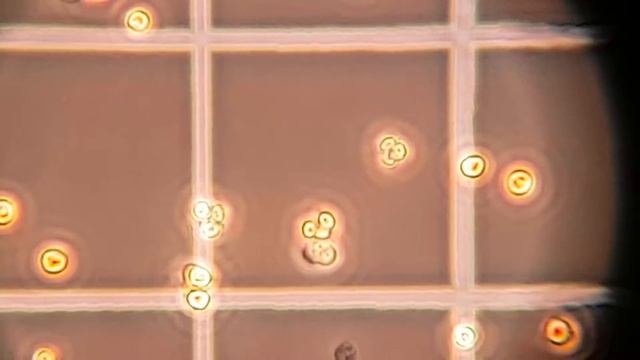 Chlorella au microscope смотреть онлайн
