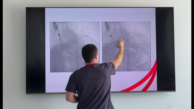 Каспийские встречи 2025 смотреть онлайн