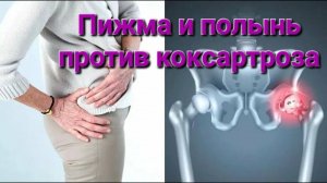 Боль в левом тазобедренном суставе, боль в левом колене, ЗАПОР,  живот  под пупком. ЧТО ДЕЛАТЬ???