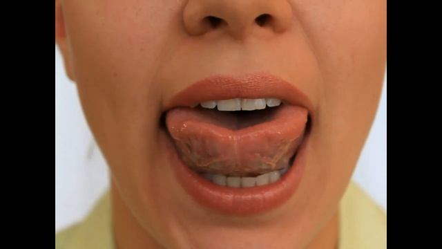 Артикуляционная Гимнастика - Чашка и Блюдце