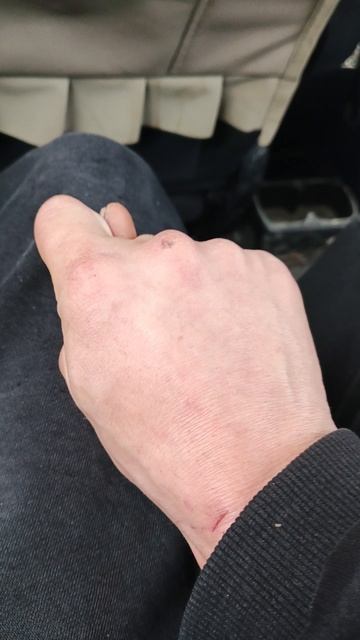 как скачет лягушка