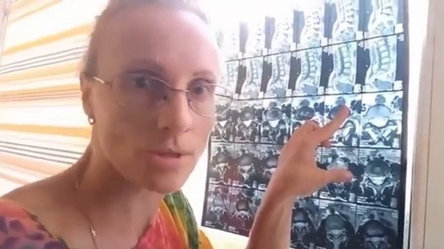 протрузии в спине,сколиоз,боли в спине