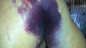 ПОРВАЛА ВАГИНУ 18+