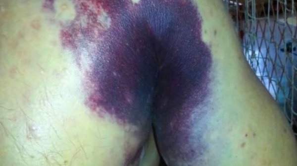 ПОРВАЛА ВАГИНУ 18+