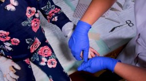 Бинтование пальцев рук