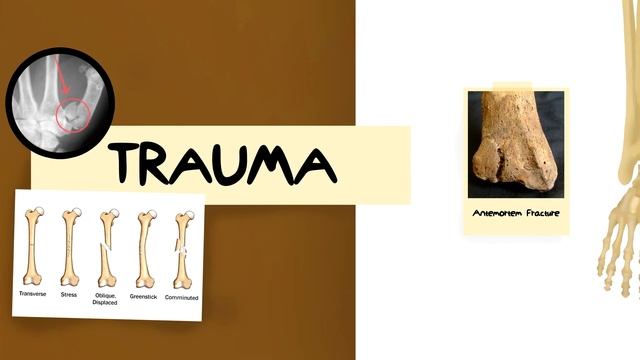 York Students' Osteological Report смотреть онлайн