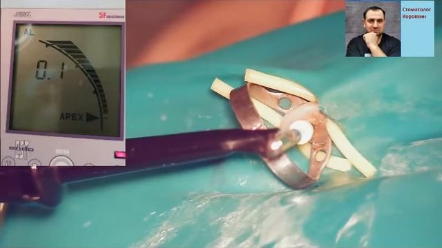 Работа с Апекс локатором #1. смотреть онлайн