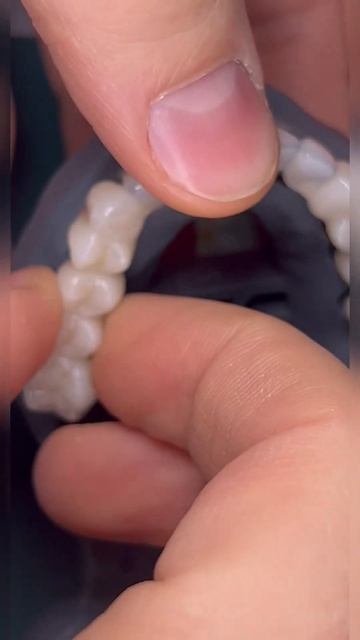 Полностью цифровой протокол изготовления коронок. 👌