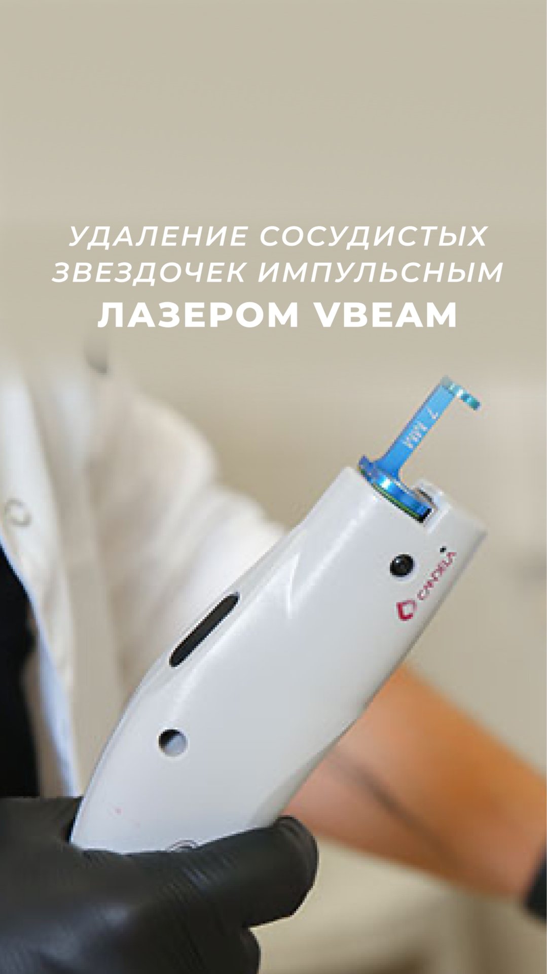 Удаление сосудистых звездочек с помощью лазера VBeam