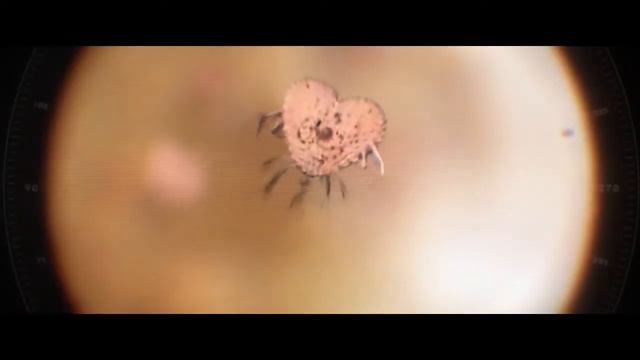 Болезнь любви 2013 Космическая страсть смотреть онлайн