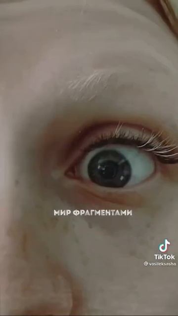 Обострение шизофрении