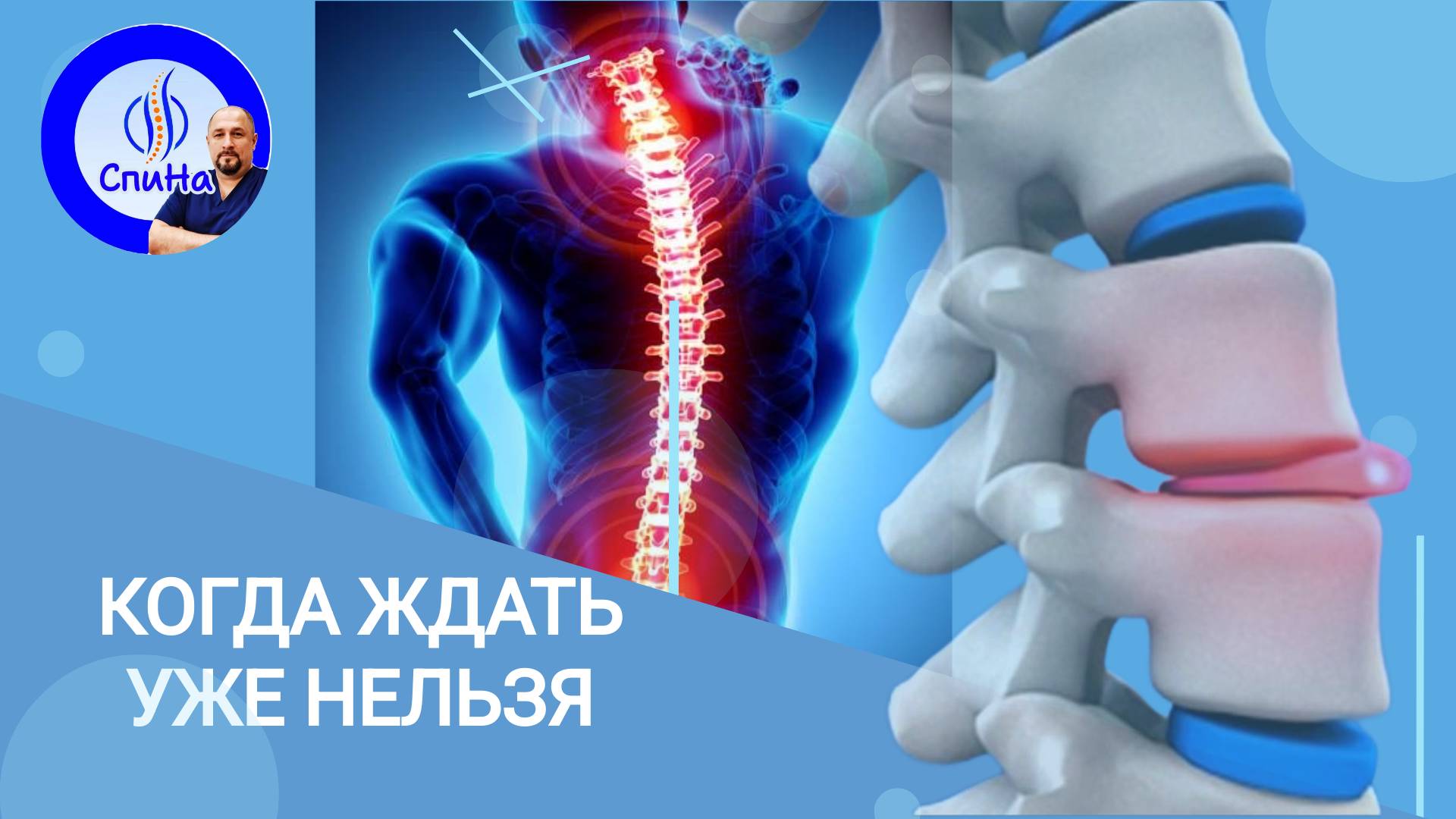 Когда нужно делать операцию, а когда можно избежать. #костоправмосква #грыжапозвоночника #чтоделать смотреть онлайн