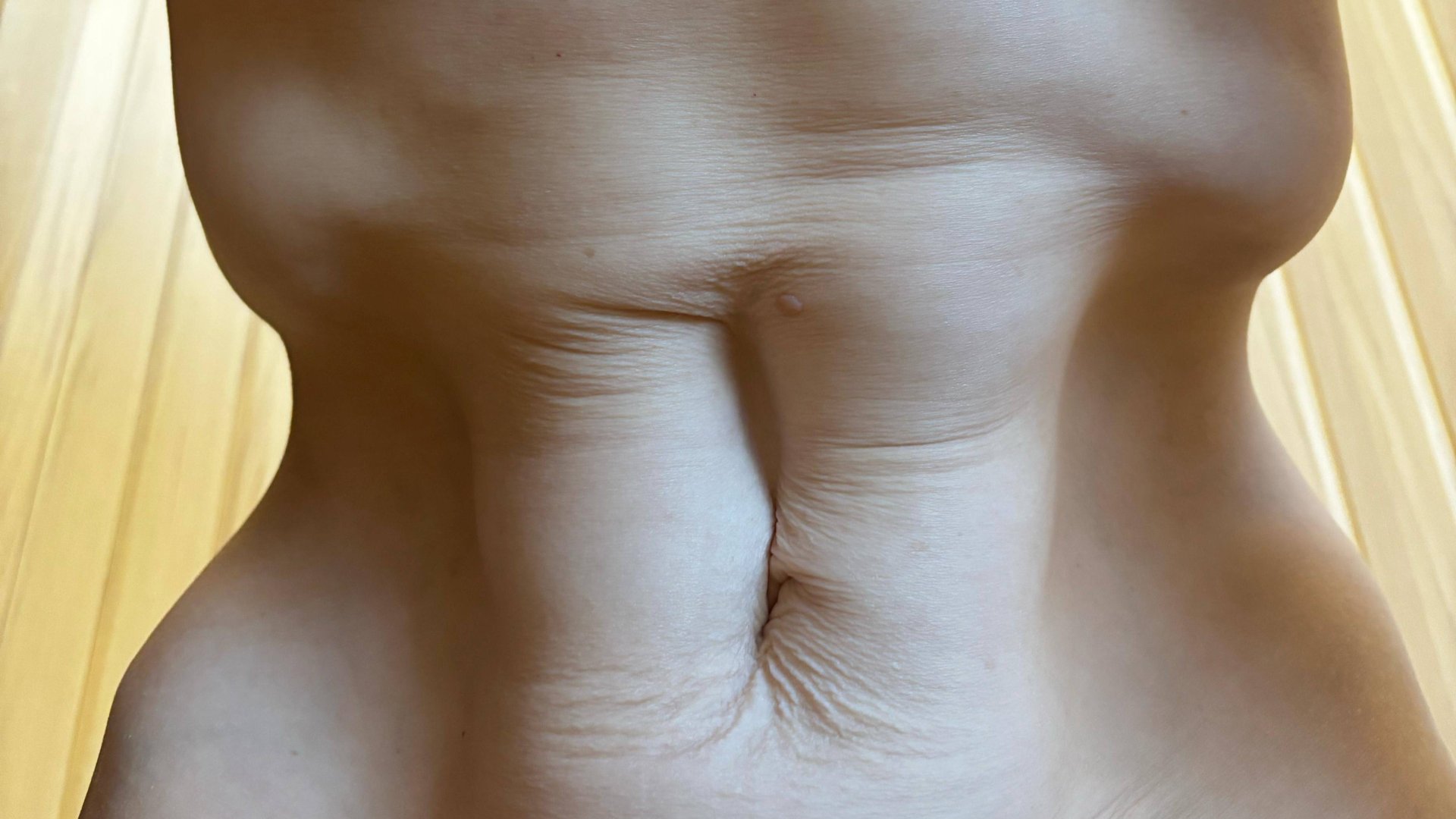 УЗИ при диастазе прямых мышц живота. Также есть  и паховая грыжа.