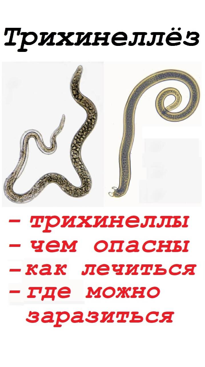 Дикая природа. Трихинеллёз. Быстрый и беспощадный убийца смотреть онлайн