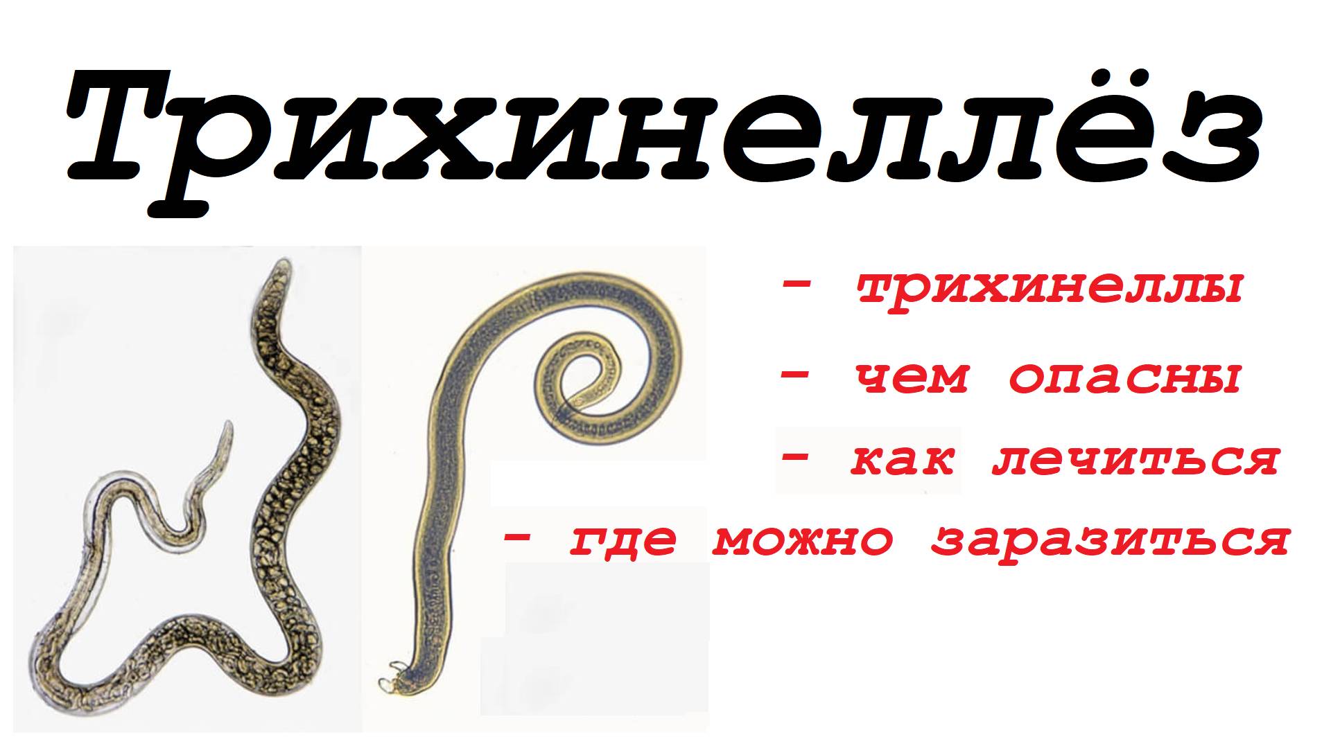 Дикая природа. Трихинеллёз. Быстрый и беспощадный убийца смотреть онлайн