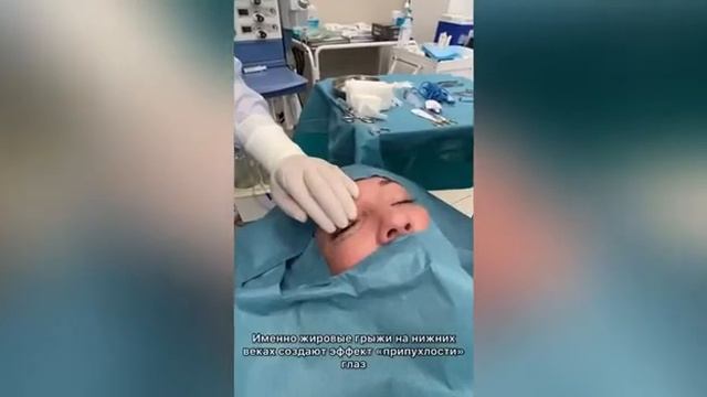 Блефаропластика в клинике «Кивач» смотреть онлайн
