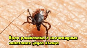 Врач рассказала о неочевидных симптомах укуса клеща